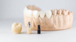 Çene kemiği yetersizliğinde implant
